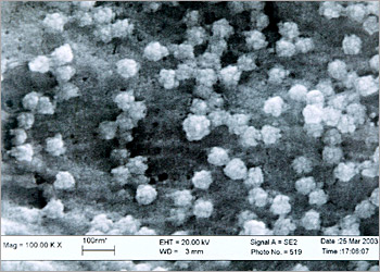 Virus infected cells are inspected under a microscope disclosed by a hospital in Hong Kong during a news conference in this March 27, 2003 file photo. Hong Kong's government said on April 21, 2003 the SARS virus had killed six more people in the city and infected 22 more people. The latest figures bring the local death toll from Severe Acute Respiratory Syndrome to 94 and a total of 1,402 cases, a government statement said. NO ARCHIVES NO SALES REUTERS/Handout/Files