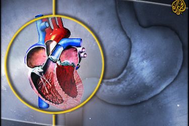 امراض المعده تؤثر على القلب