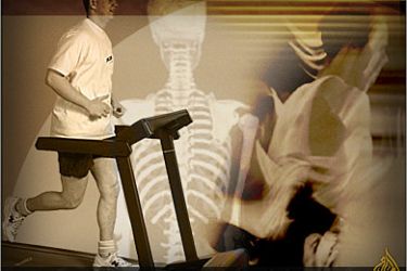 التمارين الرياضية تساعد في الوقاية من هشاشة العظام