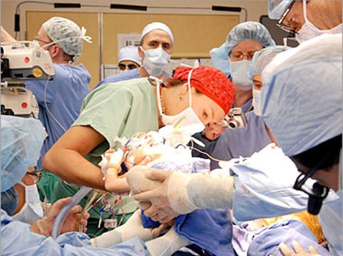REUTERS /James Stein, M.D. (2nd R), Dr. Jae Townsend, anesthesiologist (C), and the surgical team members, separate conjoined twins Regina and Renata Salinas Fierros at 6:20pm (PST) at the Children's Hospital Los Angeles, in