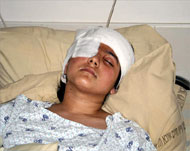 إحدى بنات أبو العيش المصابات داخل المستشفى (الجزيرة نت) 