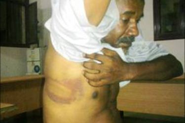 صورة تعذيب الصحفي السوداني أبوذر