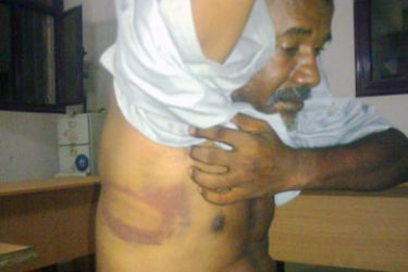 صور تعذيب الصحفي أبو ذر - السودان