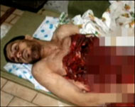 صور مروعة لجثث ضحايا الثورة في ليبيا (الجزيرة)