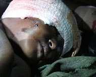 طفلة صومالية مصابة بجروح خطيرة وقد عجز الطاقم الطبي في مستشفى مريري علاجها (الجزيرة نت)
