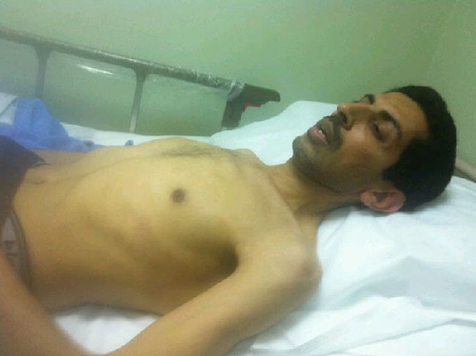 FILES) - A picture posted on the Twitpic by @angryarabia, the daughter of jailed Bahraini activist Abdulhadi al-Khawaja, is said to show him on April 5, 2012. A nearly three-month long hunger strike has turned activist Abdulhadi al-Khawaja, awaiting a final court ruling on April 30, 2012 along with 14 other jailed activists, into a symbol of Bahrain's uprising that began last year