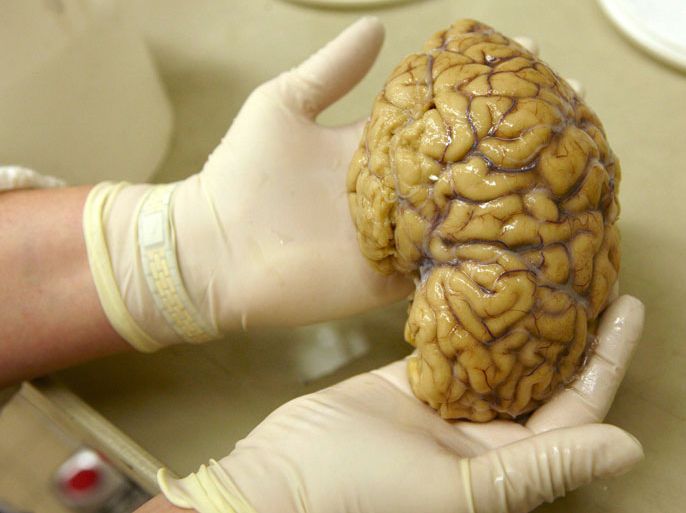 A laboratory assistant holds one hemisphere of a healthy brain in the Morphological unit of psychopathology in the Neuropsychiatry division of the Belle Idee University Hospital in Chene-Bourg near Geneva in a March 14, 2011
