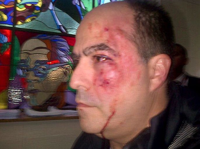 VENEZUELA : Handout picture released by the Primero Justicia party press office showing opposition deputy Julio Borges after a fight with the ruling party deputies inside the Venezuelan parliament, in Caracas on April 30, 2013.