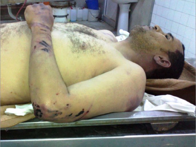صورة للمعتقل الليبي حسين التير من مدينة زليتن غربا قالت عائلته إنه توفى تحت التعذيب لدى إحدى " المليشيات " المسلحة ( الجزيرة نت- أرشيف).