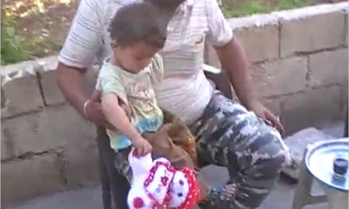 أحلام الطفولة في سوريا يدمرها نظام الأسد (صورة للطفلة شهد تبيّن مكان إعاقتها في ذراعها ( خاص للجزيرة نت )