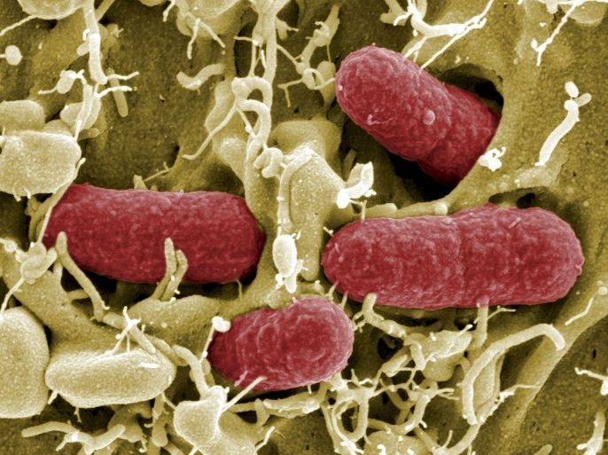 An undated file picture taken with electronic microscope shows EHEC bacteria (enterohaemorrhagic Escherichia coli) in Helmholtz Centre for Infection Research in Brunswick. The deadliest outbreak of its type on record has so far killed 23 people -- 22 in Germany and one in Sweden. Striking suddenly in the middle of a hot and sunny May, the crisis has doctors struggling to explain the outbreak and public health authorities in one of Europe's most famously organised countries stumped as to how to manage it and how to stop it happening again. To match Special Report HEALTH/ECOLI-HUNT.