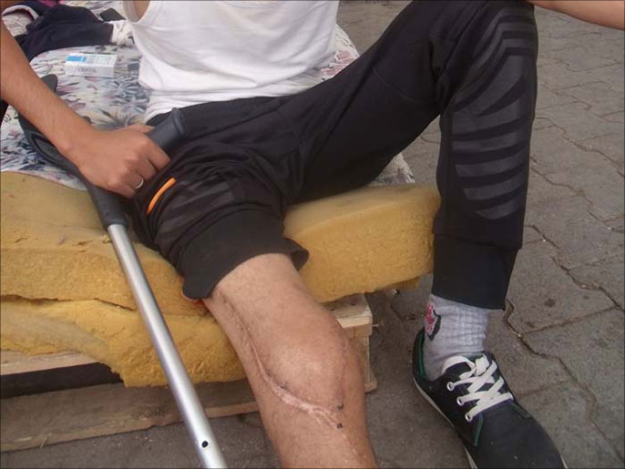 زياد القراوي أحد مصابي الثورة التونسية(الجزيرة نت)