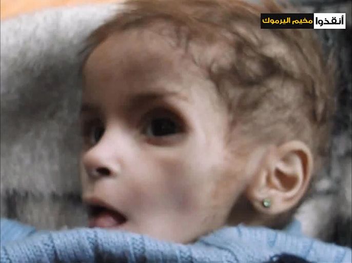 طفلة تموت جوعا بمخيم اليرموك المحاصر