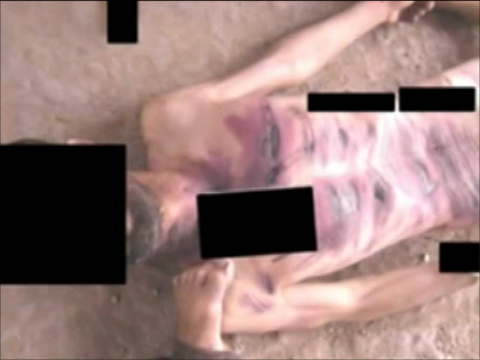 ‪من حالات التعذيب والقتل الممنهج داخل السجون السورية‬ (الجزيرة)