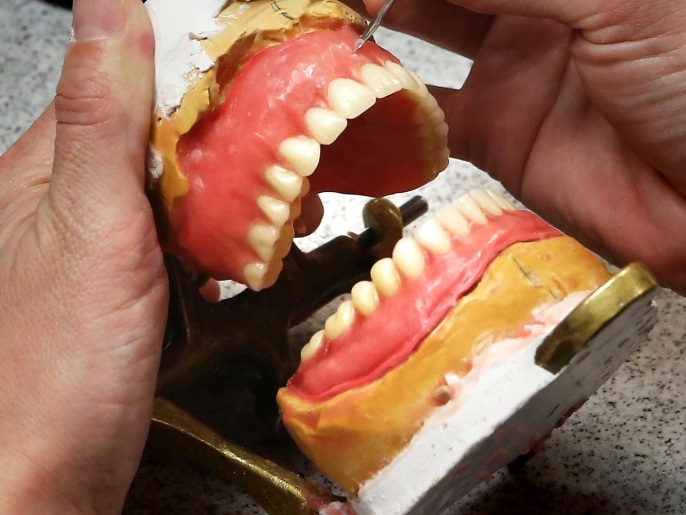 ‪في حالات نادرة قد يرجع نزيف اللثة إلى تحسس تجاه مواد طقم الأسنان‬  (أسوشيتد برس)