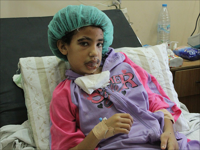 إحدى بنات حامد المصابة ترقدفي مستشفى الشفاء (الجزيرة)