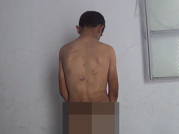 الطفل حافظ من ريف حماة وتعرضه للتعذيب