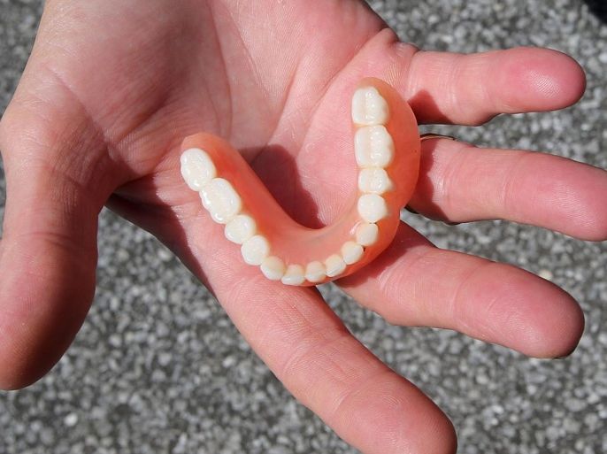 In this Aug. 26, 2014 photo, Gail Turner holds a partial set of dentures in Panama City, Fla. Turner's nephew found them on a camp chair on Aug. 2 while cleaning the street following the Friday Fest in downtown Panama City. (AP Photo/News Herald, Andrew Wardlow)