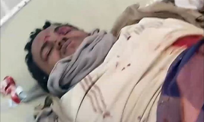 قتلى وجرحى من المدنيين جراء قصف الحوثيين عدن