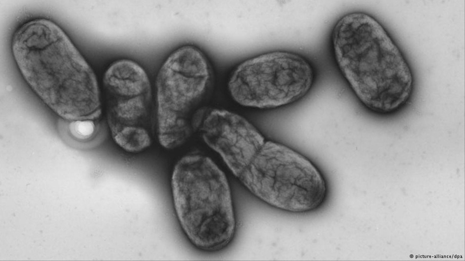 ‪بكتيريا الطاعون‬ (بكتشر ايليانس/دويتشه فيله)