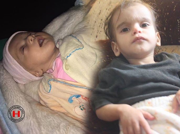 وفاة طفل يبلغ من العمر ثلاثة أشهر وطفلة أخرى بحالة خطرة جراء سوء التغذية وعدم توفر الأدوية بسبب الحصار المفروض على المدينة.