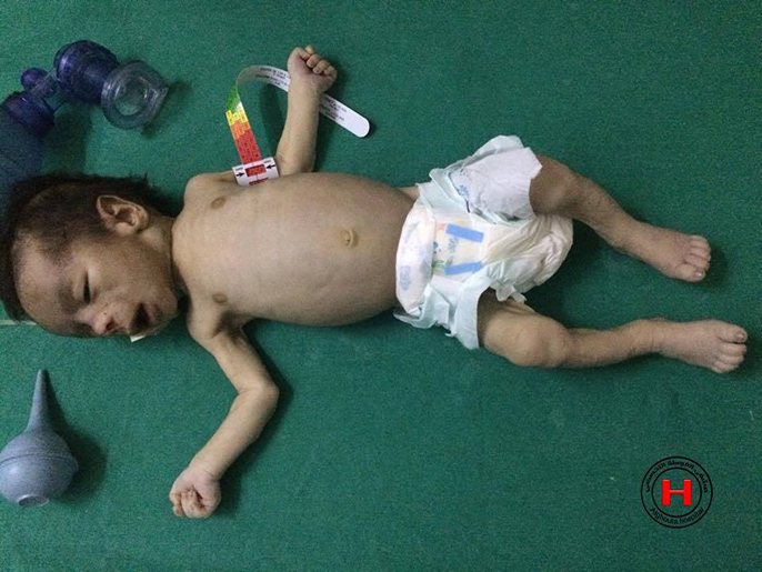 ‪‬ الرضيع يوسف سعدية (ثلاثة أشهر) توفي اليوم بسبب سوء التغذية وغياب الأدوية(ناشطون)