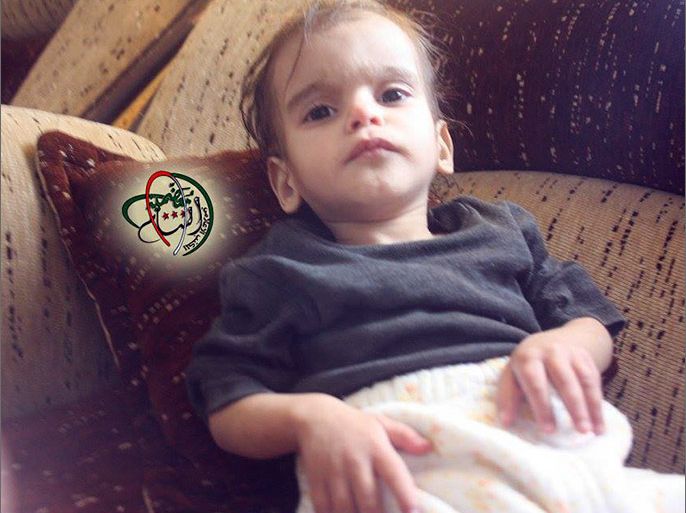 الصورة لطفلة من معظمية الشام تعاني الجوع