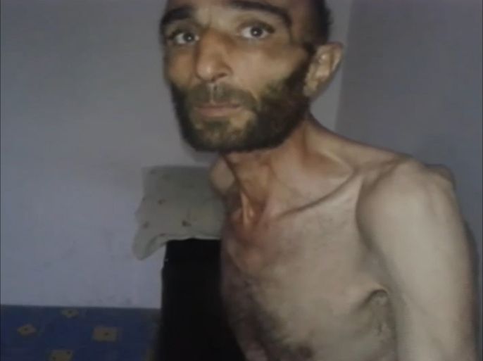 المتوفى علي عوكرو، وهو من النازحين من مدينة الزبداني إلى مضايا . وقد ظهر قبل نحو أسبوعين في شريط فيديو شاكيا حالته الحرجة بسبب الجوع.