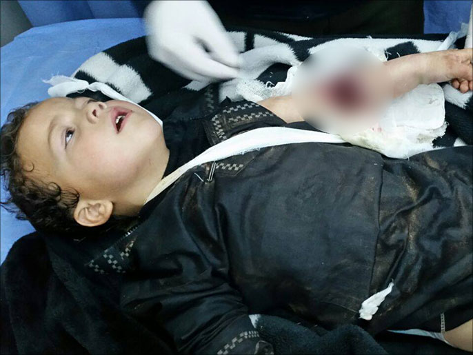 ‪معالجة أحد الأطفال الجرحى في مستشفى بالأردن بعد نقله من سوريا‬ (الجزيرة)