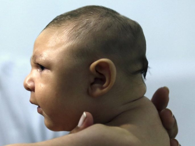 Therapist Rozely Fontoura holds Juan Pedro, who has microcephaly, in Recife, Brazil March 26, 2016. When Daniele Santos gave birth to a baby boy with microcephaly, a serious birth defect linked to the Zika infection, she was distraught. She was left to look after Juan Pedro alone after her husband left. In addition to traditional treatment at a hospital in Recife, Santos is learning therapeutic massage from an NGO to help alleviate Pedro's symptoms. REUTERS/Paulo Whitaker SEARCH "PEDRO PAULO" FOR THIS STORY. SEARCH "THE WIDER IMAGE" FOR ALL STORIES