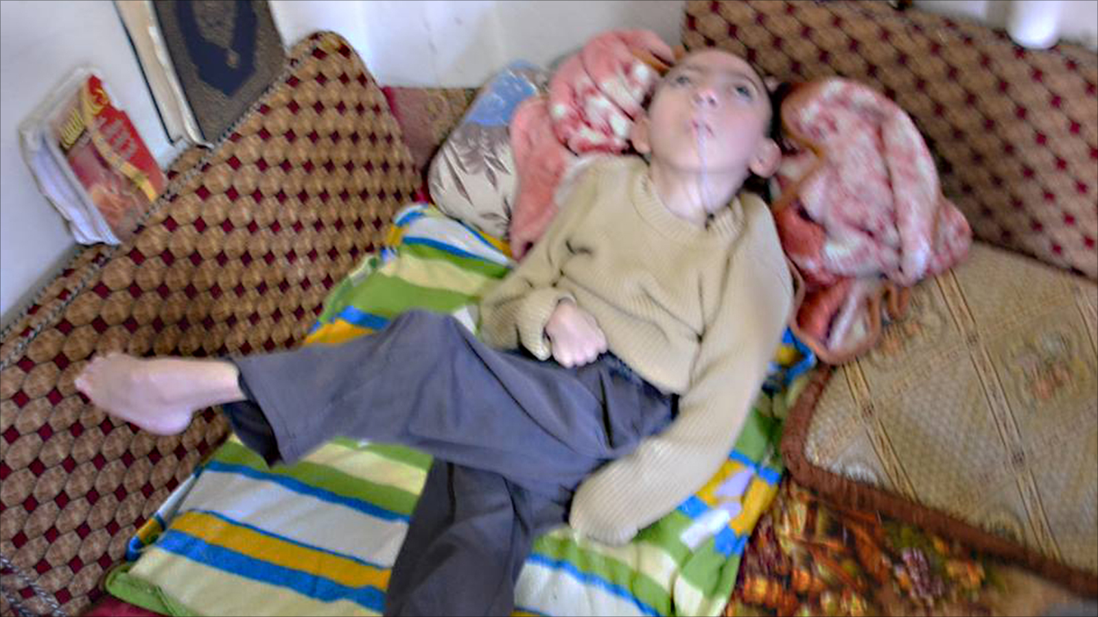 عبد الإله طفل توقف عن الحركة والنطق والقدرة على تناول الطعام بسبب انعدام الرعاية الطبية (الجزيرة نت)