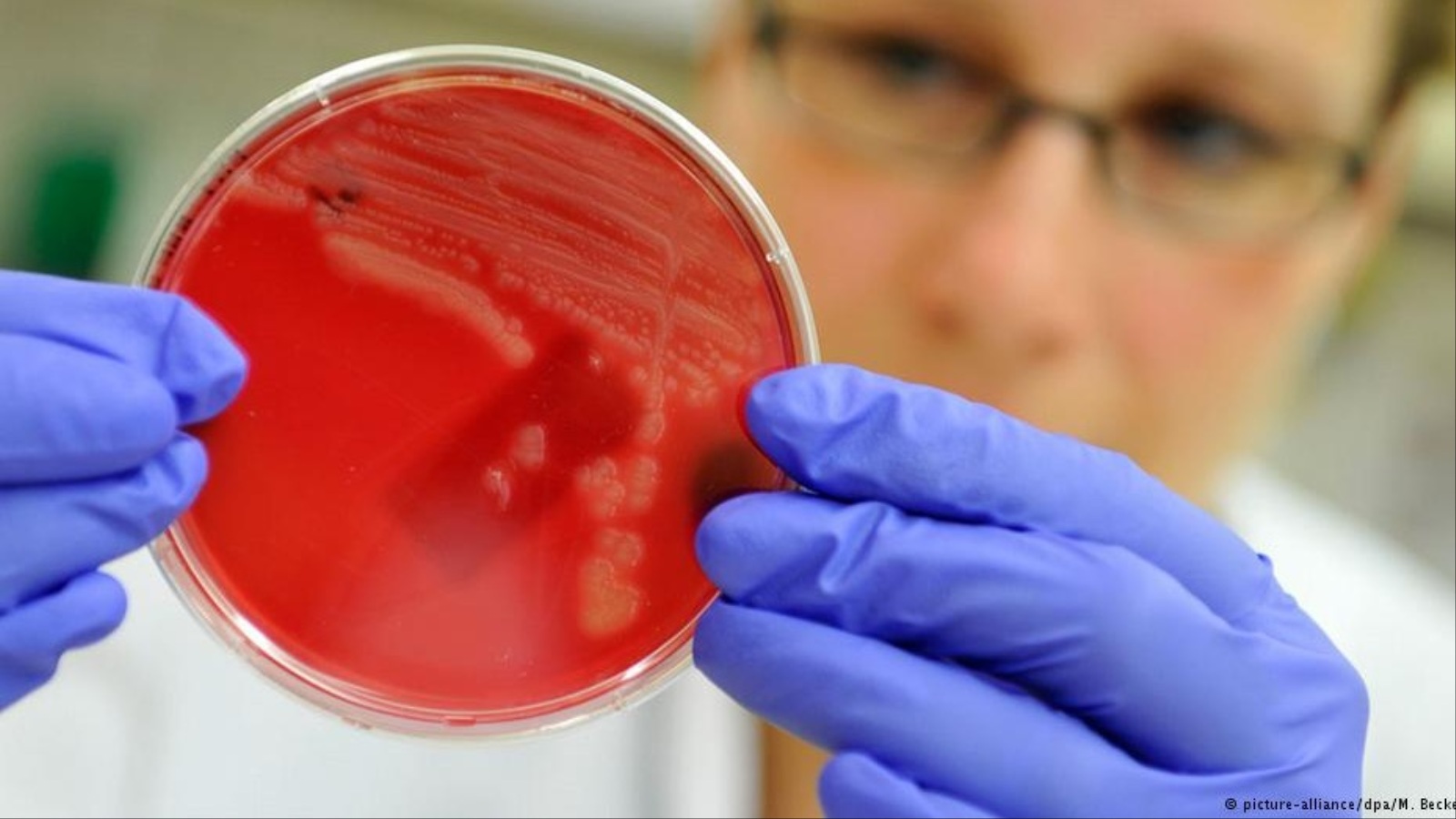 ‪اكتشاف آلية مقاومة البكتيريا للمضادات يفتح الطريق أمام عقاقير جديدة‬  (دويتشه فيله)