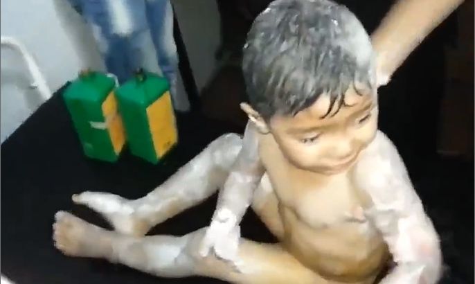 طفل يحترق جسده بقنابل النابالم في حمص