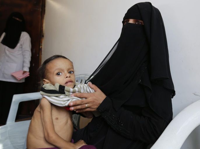A Yemeni woman holds her child suffering from malnutrition in a charity medical center in Sana'a, Yemen, 14 December 2016. According to reports, the United Nations Children’s Fund (UNICEF) has announced that 2.2 million Yemeni children are suffering from severe malnutrition and are in urgent need of care due to a 20 month-conflict between the Saudi-backed Yemeni government and the Houthi rebels.