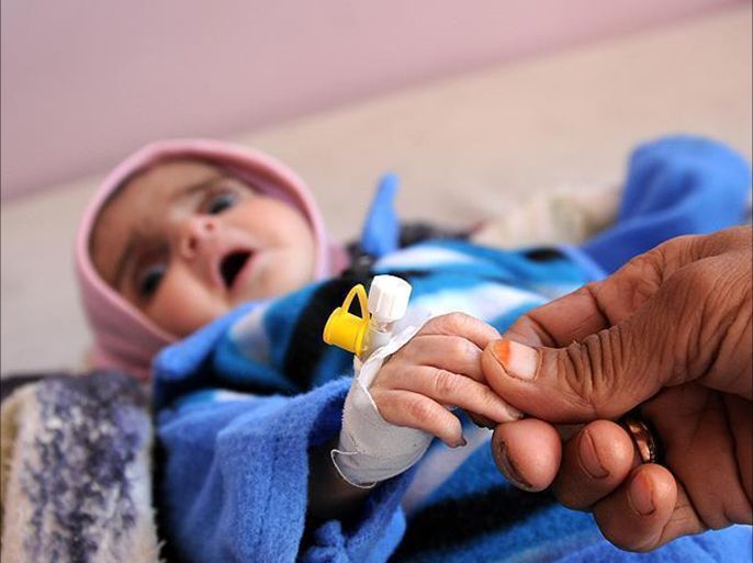 مستشفى يمني يطلق نداء استغاثة عقب وصول عدد كبير من المصابين بالكوليرا