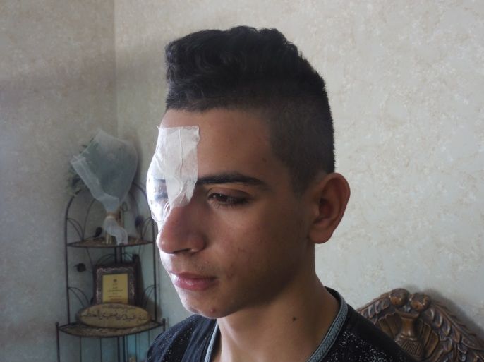 صورة الطفل المصاب عمار الخطيب- أصيب برصاصة معدنية مغلفة بالمطاط في بلدة حزما بالقدس