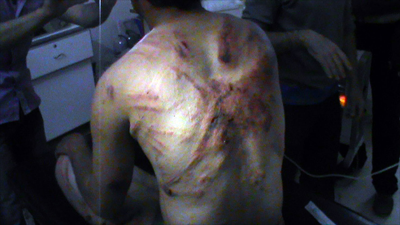 سوري في مدينة الرستن بريف حمص آخر نيسان/أبريل 2012 يقول إنه تعرض للتعذيب على يد قوات النظام (الفرنسية)