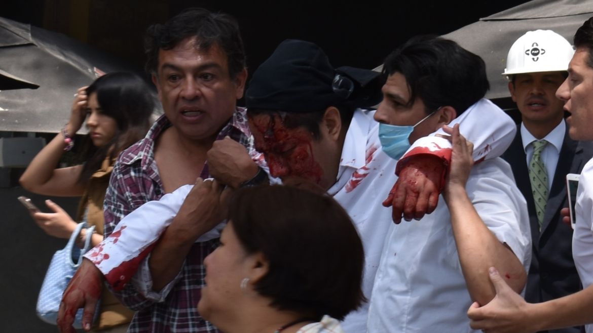 People help a wounded man after an earthquake in Mexico City on September 19, 2017. The number of people killed in a devastating earthquake that struck Mexico City and nearby regions has risen to 138, the government said. / AFP PHOTO / Kevin CHRISMAN        (Photo credit should read KEVIN CHRISMAN/AFP/Getty Images)