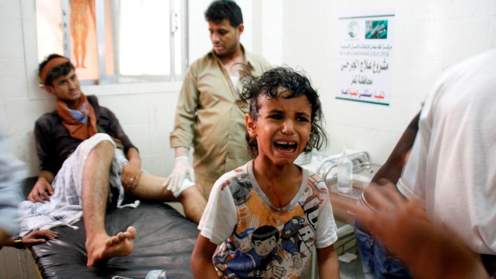‪أطفال أصيبوا بقصف الحوثيين وصالح على تعز في يونيو/حزيران الماضي‬  أطفال أصيبوا بقصف الحوثيين وصالح على تعز في يونيو/حزيران الماضي (رويترز)