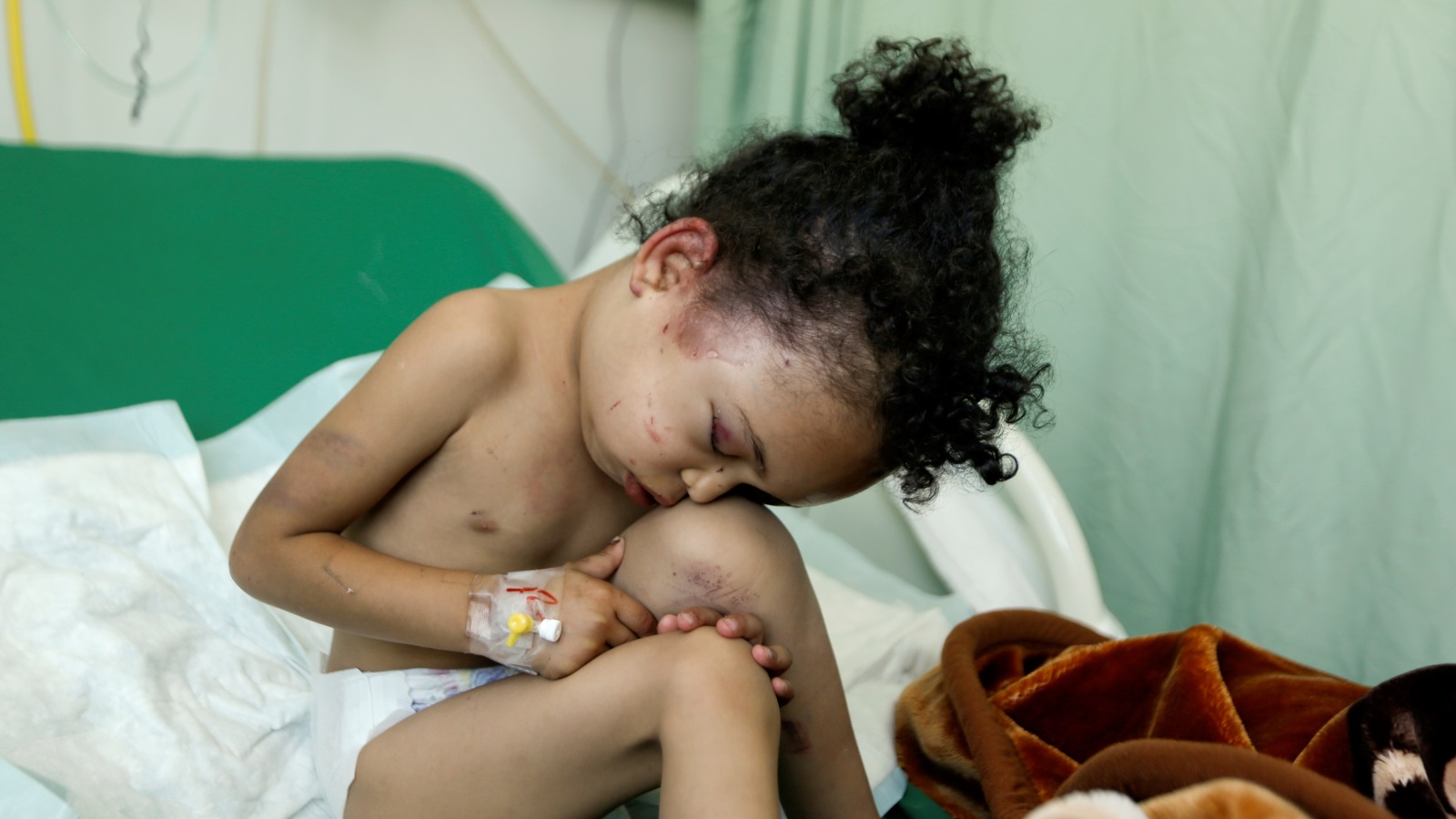 الطفلة بثينة نجت من قصف جوي تقوده السعودية على منزلها ذهب ضحيته عدد من أفراد أسرتها في صنعاء أواخر أغسطس/آب 2017 (رويترز)