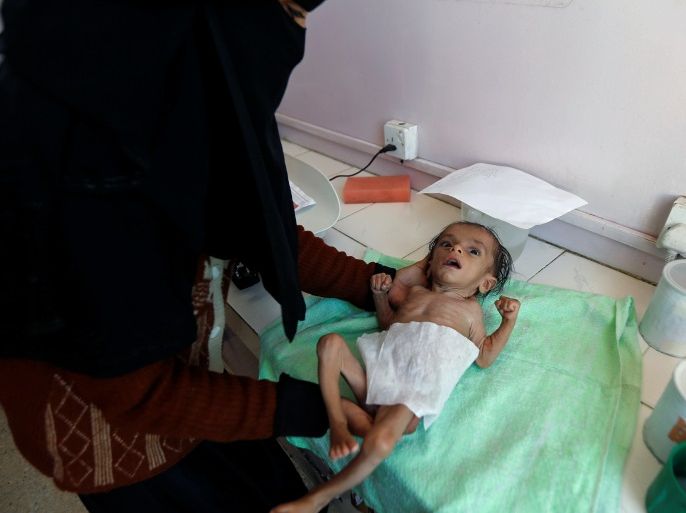 A woman picks up her son from a weighing scale at a malnutrition treatment center in Sanaa, Yemen November 22, 2017. REUTERS/Khaled Abdullah