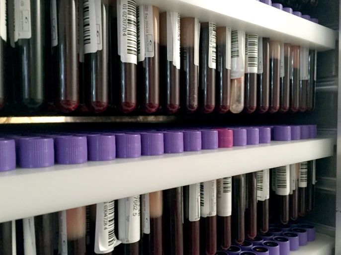 عينات دم في شركة “ديكود”للأبحاث الجينية والوراثية. صور: Theresa Münch/dpa