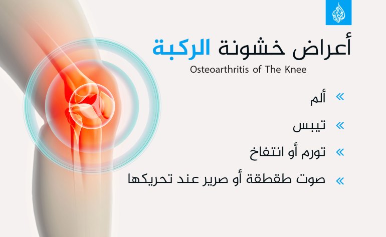 خشونة الركبة التهاب المفاصل الفصال العظمي Osteoarthritis of the knee