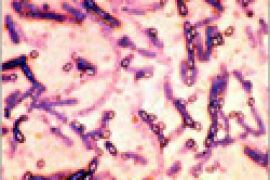 صورة ميكروسكوبية لأبواغ وخلايا حية لبكتيريا الجمرة الخبيثة (أنتراكس) التي تسبب الداء