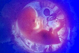 Human fetus جنين داخل الرحم