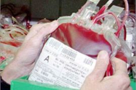 Blood storage bag, held in hands - - المصدر أسوشيتد برس