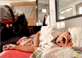 Ali Mustafa, 5, recuperates at the Qaddamiyyah Hospital in the wing for victims of cluster bombs, April 19, 2003. Ali was out playing with his siblings in their Baghdad garden on April 11 when they found a cluster bomb and it exploded. "I lost my mind," said his mother, Muna Hassan (L), when she found all her children covered in blood. Ali suffers from shrapnel wounds all over his body and may lose his eyesight. REUTERS/Cheryl Diaz Meyer/The Dallas Morning News FORT WORTH OUT, MANDATORY CREDIT, NO SALES, NO MAGS, NO ARCHIVE