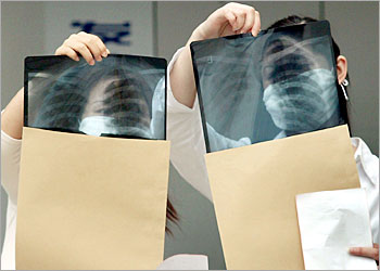 A doctor goes through a set of chest x-ray scans with a patient at a hospital in the eastern Chinese city of Hangzhou, 14 May 2003. China 14 May reported the lowest number of Severe Acute Respiratory Syndrome (SARS) cases since the government admitted covering up the extent of the epidemic, with just 16 new infections outside Beijing among a population of 1.3 billion, as the new figures showed 55 new cases, 39 of which were in the Chinese capital, bringing the cumulative number of cases nationwide to 5,124. AFP PHOTO