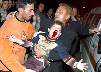 f: A seriously injured Palestinian boy is carried into Gaza City's al-Shifa hospital 28 February 2004 following an Israeli helicopter missile attack on a car in the Saftawi neghborhood just north of the city.