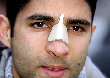 VfL Bochum's Iranian Inernational Wahid Hashemian wears a bandage on his nose 02 March 2004, after it was broken by teammate Sunday Oliseh from Nigeria during a post match brawl 28 February 2004. Oliseh was sacked by Bochum as a result of the incident